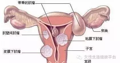 痛经困扰下的青春，一位女生的困境与解决方案探索