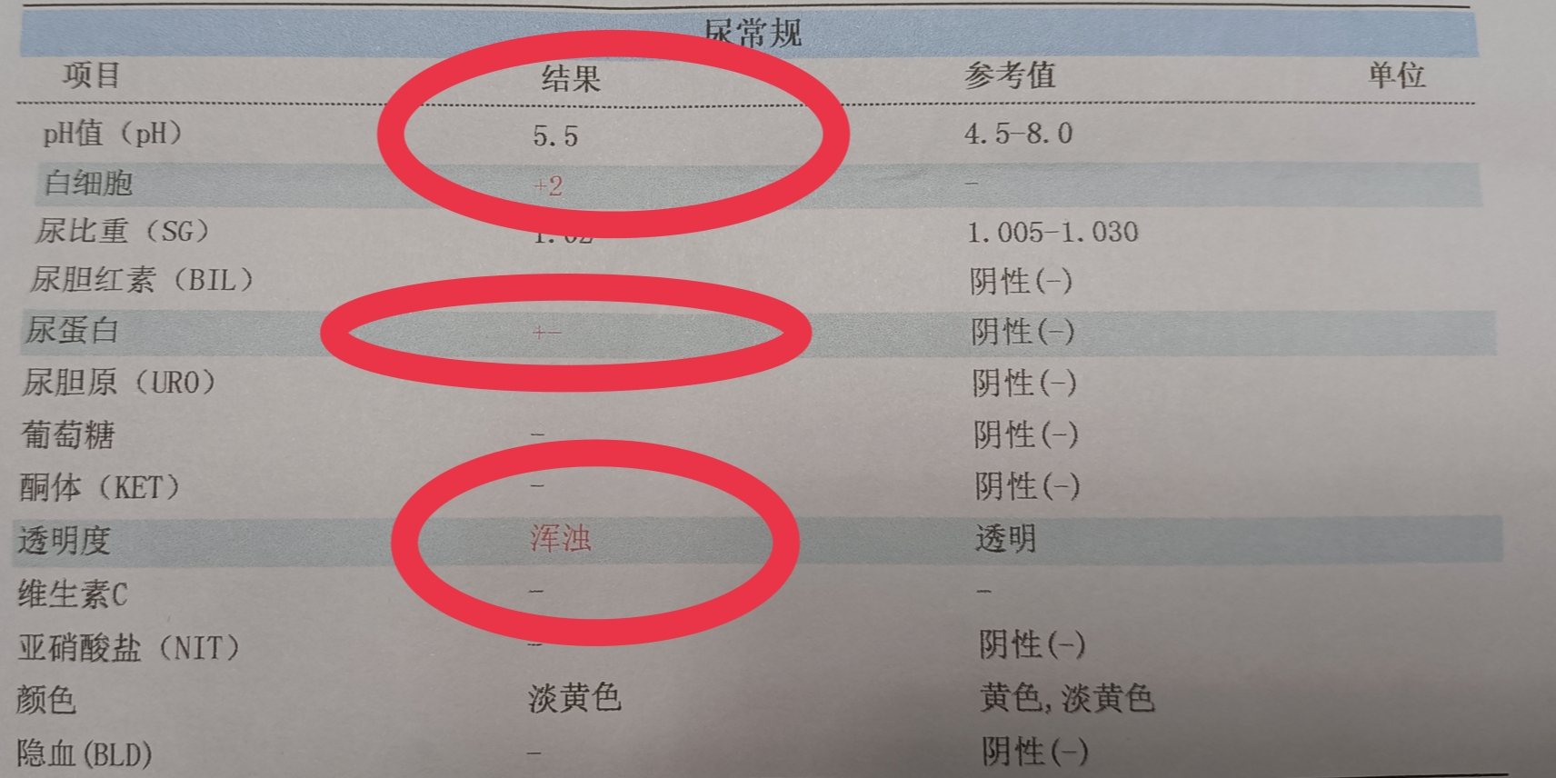 公务员尿蛋白检测，解读、应对策略及健康指引